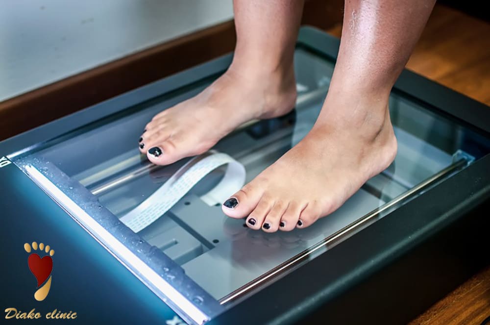 اسکن استاتیک روشی برای تشخیص گودی کف پا
