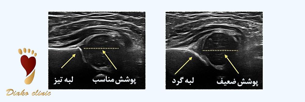 سونوگرافی جهت تشخیص ناهنجاریها