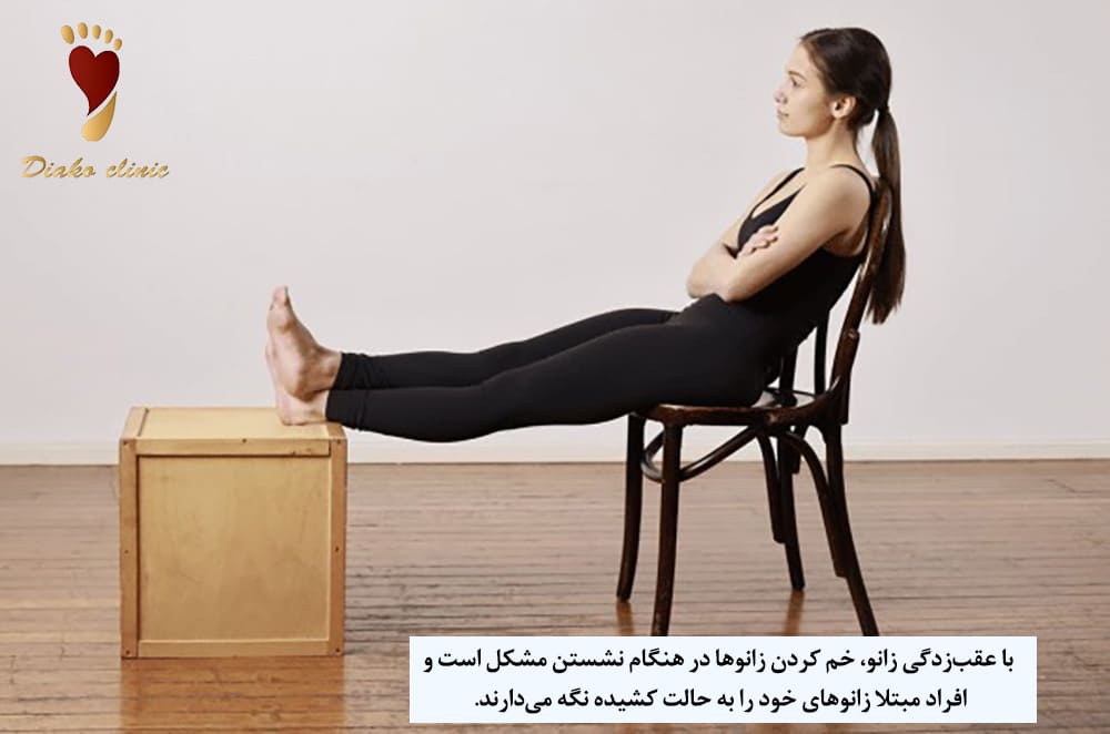 عقبزدگی زانو و تاثیر بر الگوی نشستن