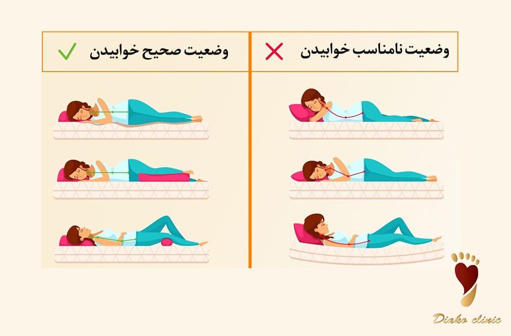 وضعیت و نحوهٔ مناسب خوابیدن