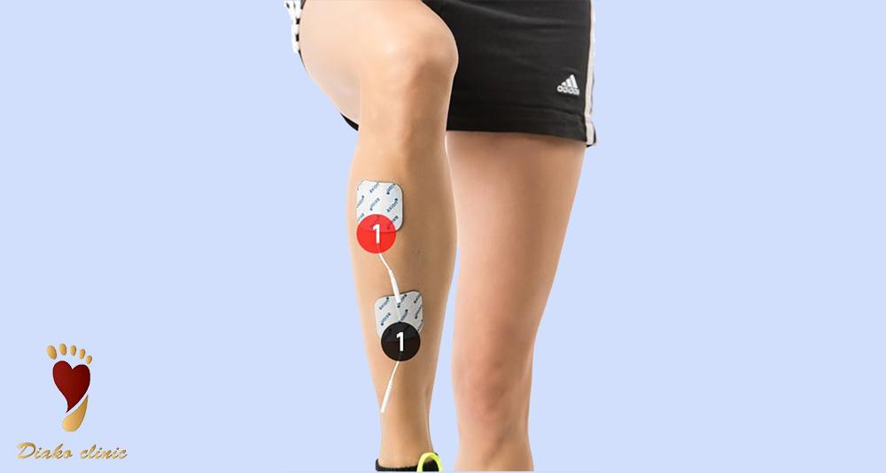 تحریک الکتریکی عضلات (EMS)