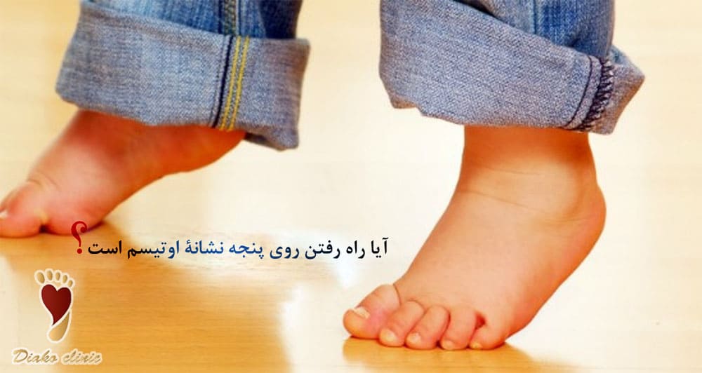 شیوع روی پنجه راه رفتن در کودکان طیف اوتیسم بیشتر است