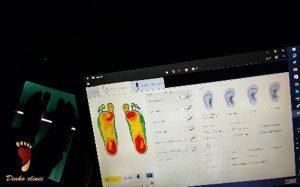ساخت کفش های طبی در مرکز دیاکو