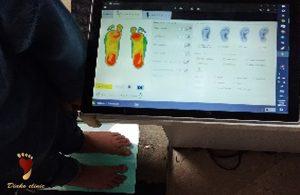 نحوه ساخت کفش های طبی در کلینیک دیاکو