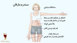 سندروم مارفان چیست؟