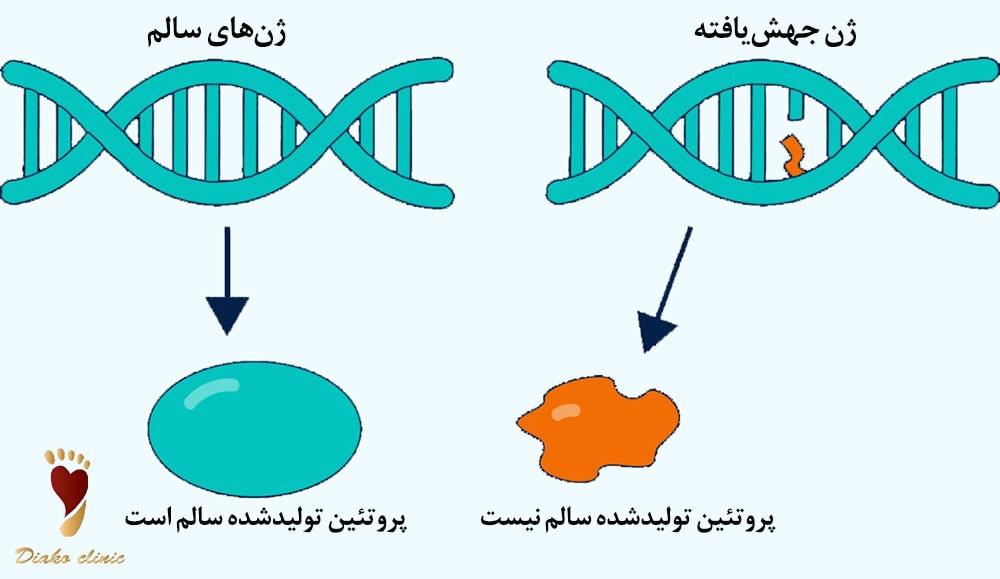 سندرم مارفان چیست