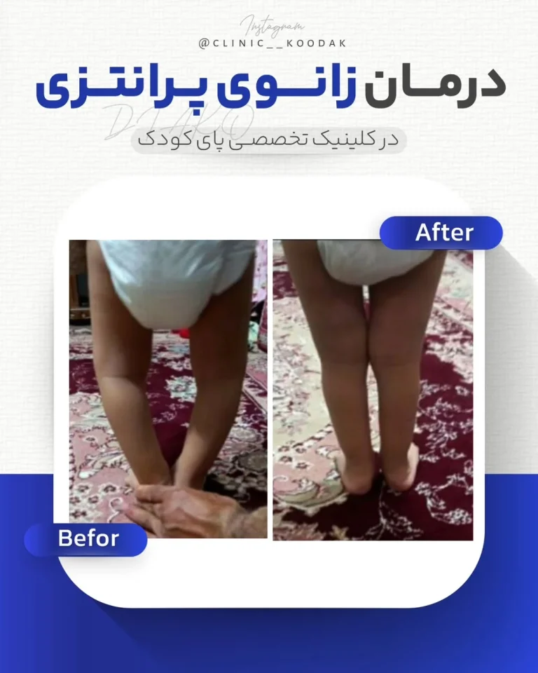 1dia