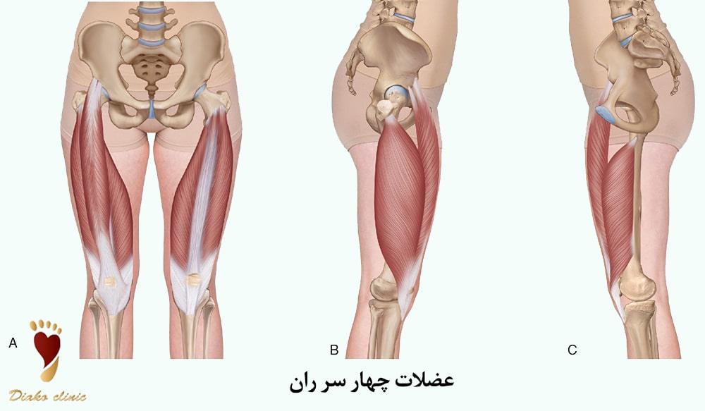 عضلات چهار سر ران