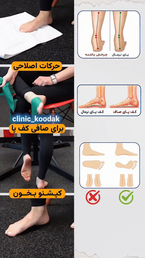 ورزش های صافی کف پا