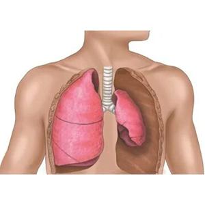 مشکلات ریوی_ احتمال بالاتر پنوموتوراکس