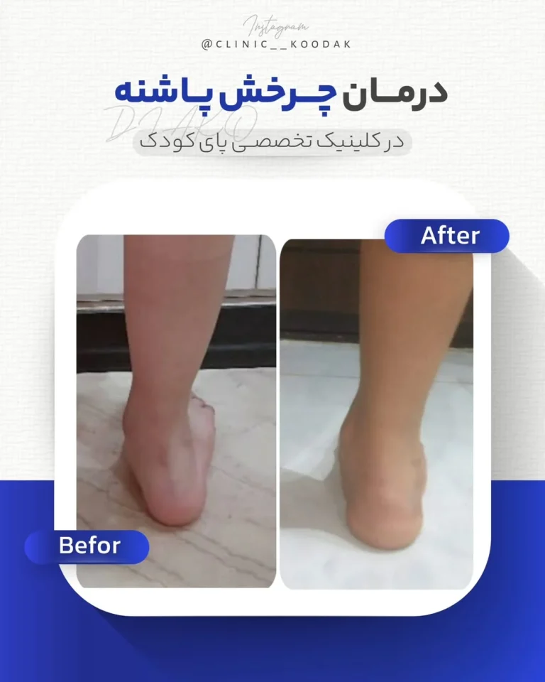 چرخش پاشنه