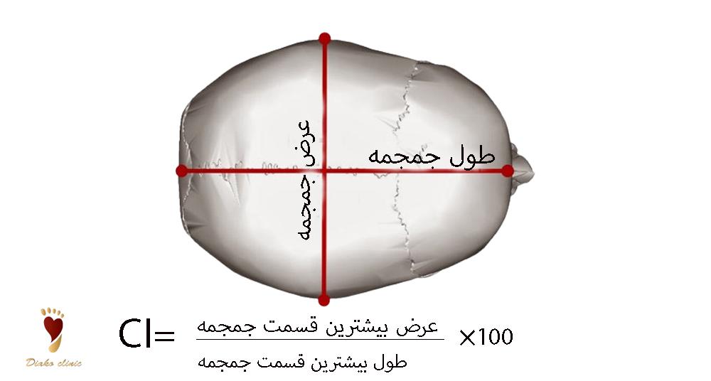 محدوده‌ی طبیعی CI