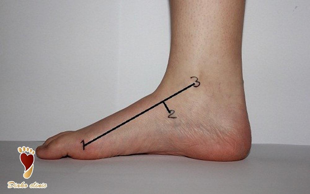 ست Feiss Line