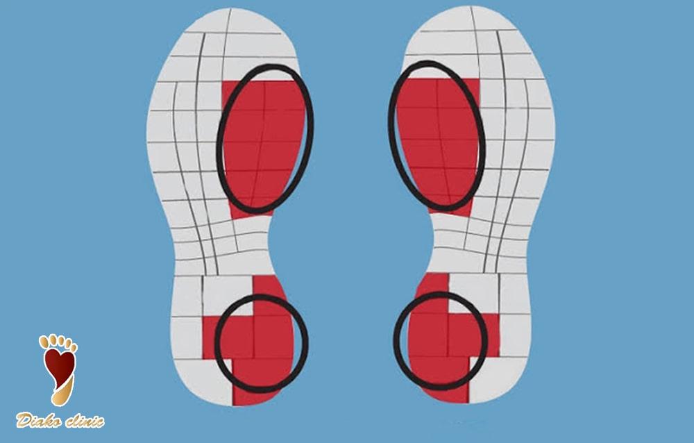 تست سایش کفش