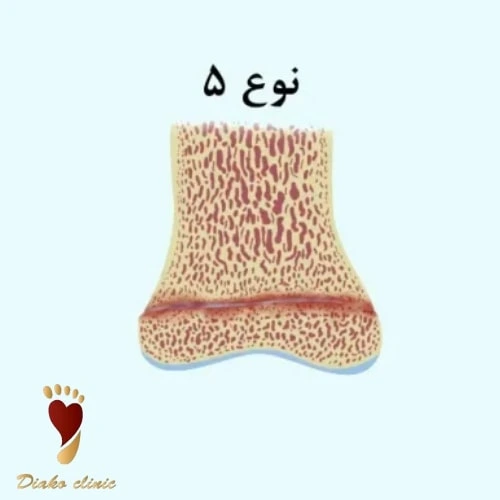 له‌شدن صفحه رشد